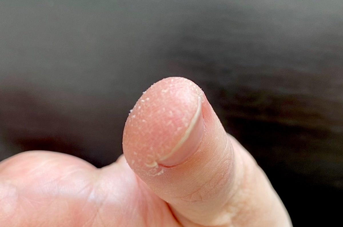 ロコベースを使用する前の指先の状態